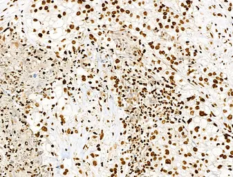 Anti-Histone H3K9K14K23K27ac (Acetyl Lys9/Lys14/Lys23/Lys27) antibody used in IHC (Paraffin sections) (IHC-P). GTX02535