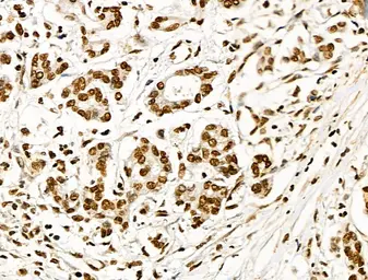 Anti-Histone H3K9K14K23K27ac (Acetyl Lys9/Lys14/Lys23/Lys27) antibody used in IHC (Paraffin sections) (IHC-P). GTX02535