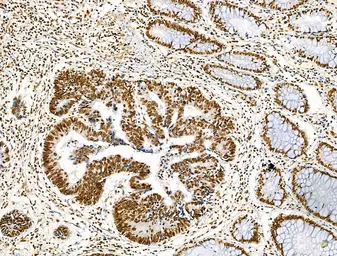 Anti-Histone H3K9K14K23K27ac (Acetyl Lys9/Lys14/Lys23/Lys27) antibody used in IHC (Paraffin sections) (IHC-P). GTX02535