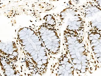 Anti-Histone H3K9K14K23K27ac (Acetyl Lys9/Lys14/Lys23/Lys27) antibody used in IHC (Paraffin sections) (IHC-P). GTX02535