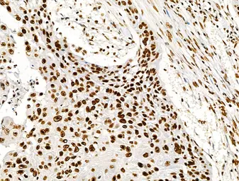 Anti-Histone H3K9K14K23K27ac (Acetyl Lys9/Lys14/Lys23/Lys27) antibody used in IHC (Paraffin sections) (IHC-P). GTX02535