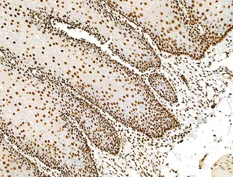 Anti-Histone H3K9K14K23K27ac (Acetyl Lys9/Lys14/Lys23/Lys27) antibody used in IHC (Paraffin sections) (IHC-P). GTX02535