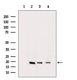 Anti-Histone H3K9K14K23K27ac (Acetyl Lys9/Lys14/Lys23/Lys27) antibody used in Western Blot (WB). GTX02535