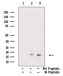 Anti-Histone H3K9K14K23K27ac (Acetyl Lys9/Lys14/Lys23/Lys27) antibody used in Western Blot (WB). GTX02535