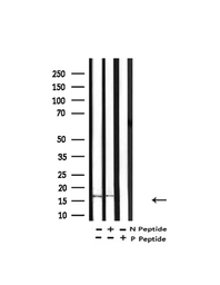 Anti-Histone H3K9K14K23K27ac (Acetyl Lys9/Lys14/Lys23/Lys27) antibody used in Western Blot (WB). GTX02535
