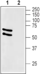 Anti-GLUT2 antibody used in Western Blot (WB). GTX02542