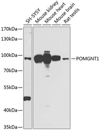 Anti-POMGNT1 antibody used in Western Blot (WB). GTX02543