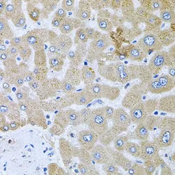 Anti-POMGNT1 antibody used in IHC (Paraffin sections) (IHC-P). GTX02543