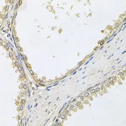 Anti-POMGNT1 antibody used in IHC (Paraffin sections) (IHC-P). GTX02543