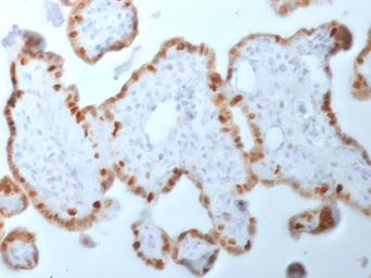 Anti-DNMT1 antibody [DNMT1/2061] used in IHC (Paraffin sections) (IHC-P). GTX02546