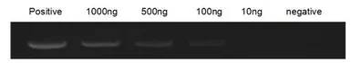 Human MMP9 protein, His tag (Active). GTX02551-pro