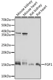 Anti-FGF1 antibody [GT1220] used in Western Blot (WB). GTX02554