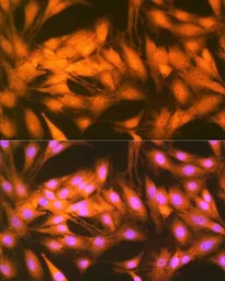 Anti-FGF1 antibody [GT1220] used in Immunocytochemistry/ Immunofluorescence (ICC/IF). GTX02554