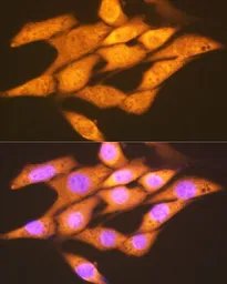 Anti-FGF1 antibody [GT1220] used in Immunocytochemistry/ Immunofluorescence (ICC/IF). GTX02554
