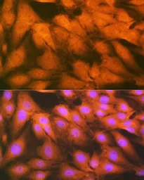 Anti-FGF1 antibody [GT1220] used in Immunocytochemistry/ Immunofluorescence (ICC/IF). GTX02554