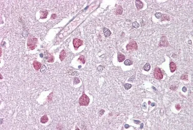 Anti-ER81 antibody used in IHC (Paraffin sections) (IHC-P). GTX02562
