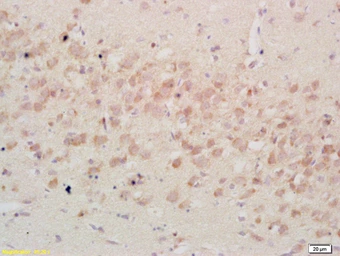 Anti-IGFBP3 antibody used in IHC (Paraffin sections) (IHC-P). GTX02574