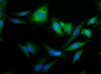 Anti-ADFP antibody used in Immunocytochemistry/ Immunofluorescence (ICC/IF). GTX02576