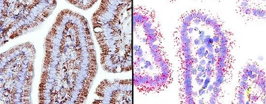 Anti-ADFP antibody used in IHC (Paraffin sections) and In situ hybridization (IHC-P ISH). GTX02576