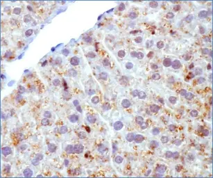 Anti-ADFP antibody used in IHC (Paraffin sections) (IHC-P). GTX02576