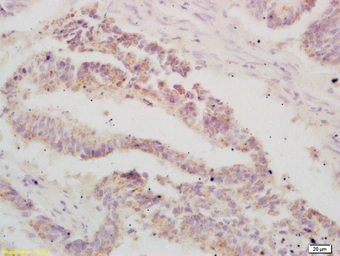 Anti-ATF3 antibody used in IHC (Paraffin sections) (IHC-P). GTX02578