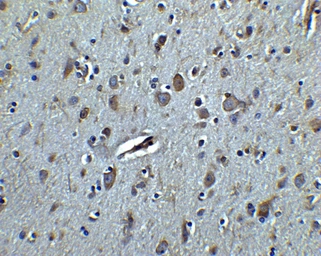 Anti-TET3 antibody used in IHC (Paraffin sections) (IHC-P). GTX02579