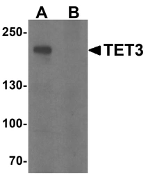 Anti-TET3 antibody used in Western Blot (WB). GTX02579