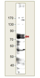 Anti-LIMK1 antibody used in Western Blot (WB). GTX02581