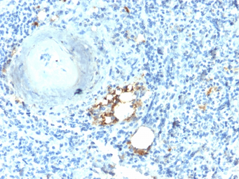 Anti-TRAP antibody [ACP5/2336R] used in IHC (Paraffin sections) (IHC-P). GTX02582