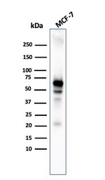 Anti-AKT1 antibody [AKT1/3898R] used in Western Blot (WB). GTX02584