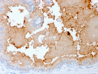Anti-AMACR antibody [rAMACR/1864] used in IHC (Paraffin sections) (IHC-P). GTX02585