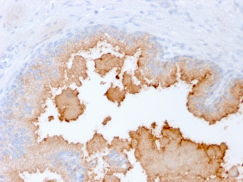 Anti-AMACR antibody [rAMACR/1864] used in IHC (Paraffin sections) (IHC-P). GTX02585
