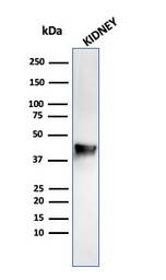 Anti-AMACR antibody [rAMACR/1864] used in Western Blot (WB). GTX02585