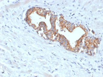 Anti-AMACR antibody [AMACR/4572R] used in IHC (Paraffin sections) (IHC-P). GTX02586