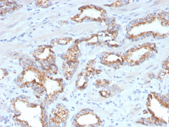 Anti-AMACR antibody [AMACR/4572R] used in IHC (Paraffin sections) (IHC-P). GTX02586