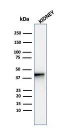 Anti-AMACR antibody [AMACR/4572R] used in Western Blot (WB). GTX02586