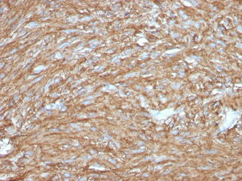 Anti-TMEM16A antibody [DG1/2831R] used in IHC (Paraffin sections) (IHC-P). GTX02589