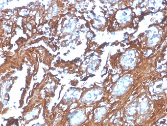 Anti-Annexin A1 antibody [rANXA1/4310] used in IHC (Paraffin sections) (IHC-P). GTX02591