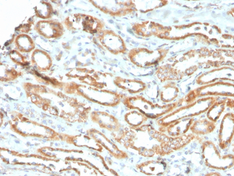 Anti-Aurora B antibody [rAURKB/1592] used in IHC (Paraffin sections) (IHC-P). GTX02594