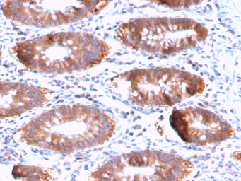 Anti-Aurora B antibody [AURKB/3121R] used in IHC (Paraffin sections) (IHC-P). GTX02595