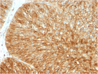 Anti-beta 2 Microglobulin antibody [B2M/1857R] used in IHC (Paraffin sections) (IHC-P). GTX02596