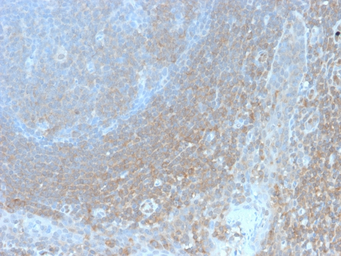 Anti-BCL10 antibody [BL10/2988R] used in IHC (Paraffin sections) (IHC-P). GTX02597
