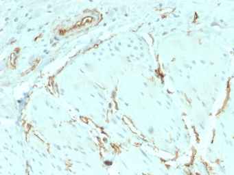 Anti-CD34 antibody [HPCA1/2598R] used in IHC (Paraffin sections) (IHC-P). GTX02602