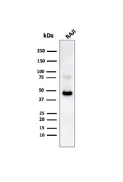 Anti-CD38 antibody [CD38/4247R] used in Western Blot (WB). GTX02603