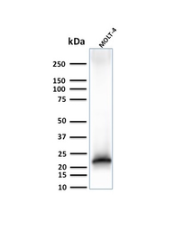 Anti-CD3 epsilon antibody [C3e/3125R] used in Western Blot (WB). GTX02605
