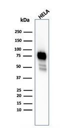 Anti-CD44 antibody [HCAM/2875R] used in Western Blot (WB). GTX02606