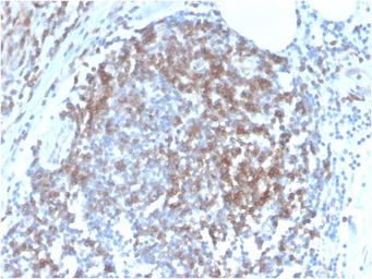 Anti-CD6 antibody [C6/2884R] used in IHC (Paraffin sections) (IHC-P). GTX02609