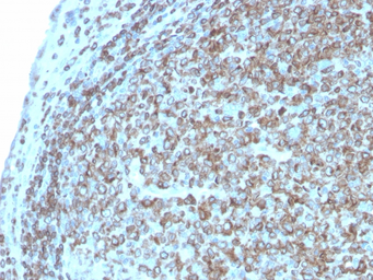 Anti-CD74 antibody [CLIP/3127R] used in IHC (Paraffin sections) (IHC-P). GTX02612