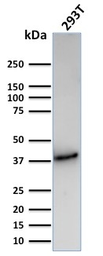 Anti-CD74 antibody [CLIP/3127R] used in Western Blot (WB). GTX02612