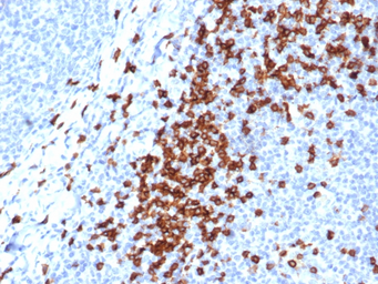 Anti-CD8 alpha antibody [CD8/4391R] used in IHC (Paraffin sections) (IHC-P). GTX02616